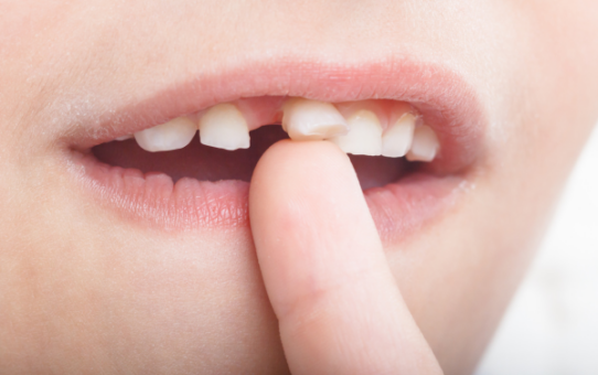 Mliečny zúbok vypadol bez bolesti